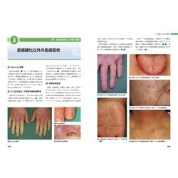 ヨドバシ.com - 皮膚科 膠原病ー皮疹から全身を診る(皮膚科ベスト 