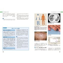 ヨドバシ.com - 皮膚科 膠原病ー皮疹から全身を診る(皮膚科ベスト