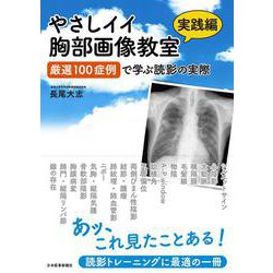 やさしイイ胸部画像教室【実践編】－厳選100症例で学ぶ読影の実際 [単行本]