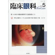 臨床眼科 2021年 05月号 [雑誌]