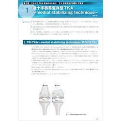 ヨドバシ.com - TKA・UKA 人工膝関節置換術パーフェクト [単行本] 通販