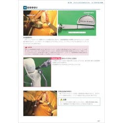 ヨドバシ.com - TKA・UKA 人工膝関節置換術パーフェクト [単行本] 通販【全品無料配達】