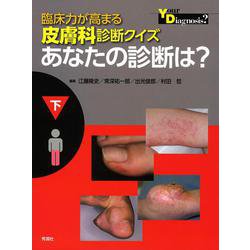 臨床力が高まる皮膚科診断クイズ　下－あなたの診断は？ [単行本]