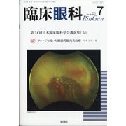 臨床眼科 2021年 07月号 [雑誌]