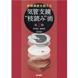 末梢病変を捉える 気管支鏡枝読み術 DVD-ROM（Windows版）付 第2版 [単行本]