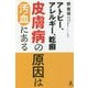 アトピー、アレルギー、乾癬 皮膚病の原因は汚血にある [単行本]