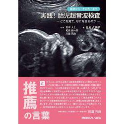 基礎から”その先”まで　実践！ 胎児超音波検査－－どこを見て，なにを診るのか－ [単行本]