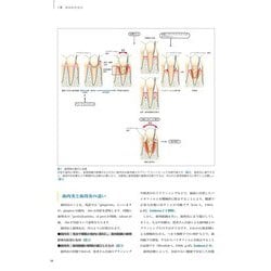 Dr.弘岡に訊く臨床的ペリオ講座 スカンジナビアンアプローチの実践 Dr.弘岡に訊く臨床的ペリオ講座 スカンジナビアンアプローチの