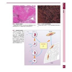 ヨドバシ.com - 解明病理学第4版 病気のメカニズムを解く 第4版 