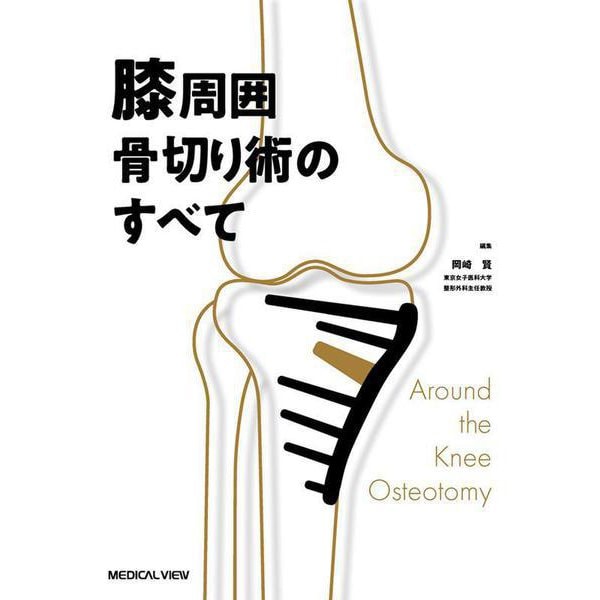 膝周囲骨切り術のすべて [単行本]