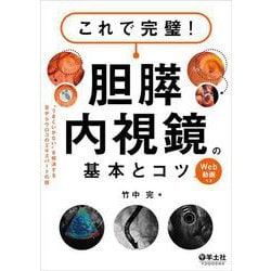 これで完璧！胆膵内視鏡の基本とコツ [単行本]