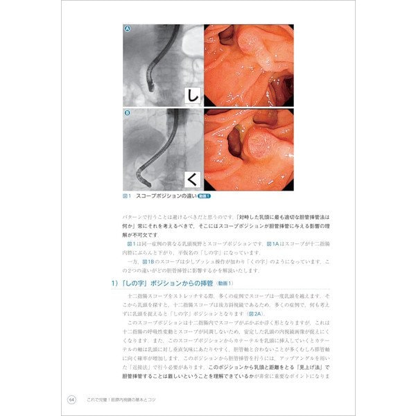 人気 これで完璧！胆膵内視鏡の基本とコツ [単行本]