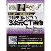 どう撮り，何を作成する？　手術支援に役立つ3次元CT画像 [単行本]
