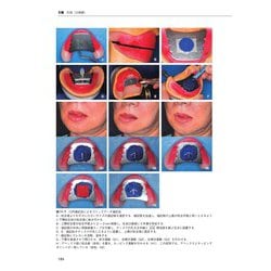ヨドバシ.com - 無歯顎補綴治療学 第4版 [単行本] 通販【全品無料配達】