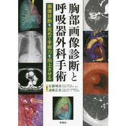 胸部画像診断と呼吸器外科手術―画像診断を究めて手術力を向上させる [単行本]