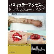 バスキュラーアクセスのトラブルシューティング [単行本]