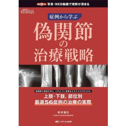 偽関節の治療戦略 : 症例から学ぶ ヨドバシ.com - 偽関節の治療戦略―症例から学ぶ [単行本] 通販