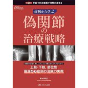 偽関節の治療戦略―症例から学ぶ [単行本]