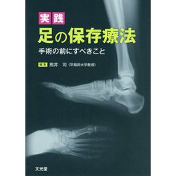 ヨドバシ.com - 実践 足の保存療法―手術の前にすべきこと [単行本 