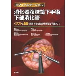 ヨドバシ.com - ビジュアルサージカル 消化器腹腔鏡下手術 下部消化管 