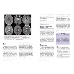 ヨドバシ.com - 小児急性脳炎・脳症のとらえ方と治療戦略―Practice and 