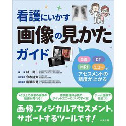 看護にいかす画像の見かたガイド―X線・CT・MRI・エコーでアセスメントの精度が上がる [単行本]