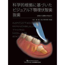 「科学的根拠に基づいた ビジュアル下顎埋伏智歯抜歯」　裁断済 41Ox1sOhxdL._AC_SY200_QL15_.jpg