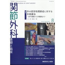 関節外科 基礎と臨床 2022年 08月号 [雑誌]