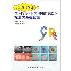 マンガで学ぶ コンポジットレジン修復に役立つ接着の基礎知識 [単行本]