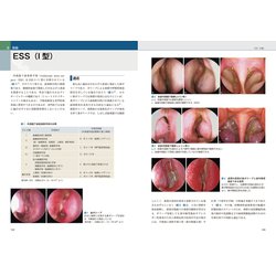 プラクティス耳鼻咽喉科の臨床 耳鼻咽喉科外来処置・外来手術最新マニュアル ヨドバシ.com - 耳鼻咽喉科 外来処置・外来手術最新マニュアル