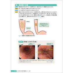 ヨドバシ.com - Dr.平澤の上部消化管内視鏡診断セミナー 上巻 [単行本
