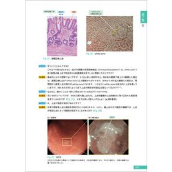 ヨドバシ.com - Dr.平澤の上部消化管内視鏡診断セミナー 下巻 [単行本
