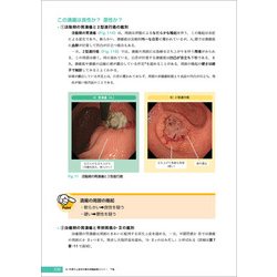 ヨドバシ.com - Dr.平澤の上部消化管内視鏡診断セミナー 下巻 [単行本