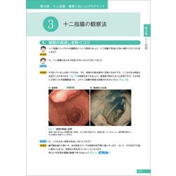 ヨドバシ.com - Dr.平澤の上部消化管内視鏡診断セミナー 下巻 [単行本