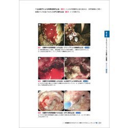 ヨドバシ.com - 胆膵内視鏡のトラブルシューティング [単行本] 通販 