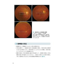 ヨドバシ.com - 神経眼科診療のてびき 第3版－病歴と診察から導く鑑別 