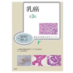 乳癌 第3版 (腫瘍病理鑑別診断アトラス) [単行本]