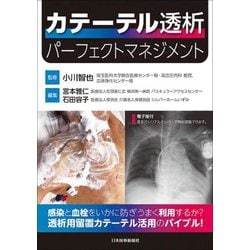 カテーテル透析 パーフェクトマネジメント [単行本]