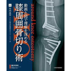 動画と図で理解を深める 膝周囲骨切り術(AKO) [単行本]