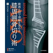 動画と図で理解を深める 膝周囲骨切り術(AKO) [単行本]