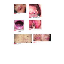 ヨドバシ.com - 歯科医師のための皮膚科学 第3版 [単行本] 通販【全品 
