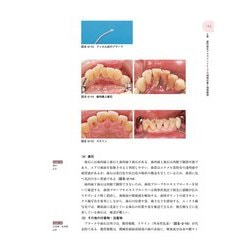 ヨドバシ.com - 歯科予防処置論・歯科保健指導論(歯科衛生学