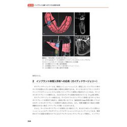 ヨドバシ.com - よくわかる口腔インプラント学 第4版 [単行本] 通販 