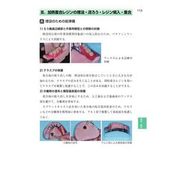 ヨドバシ.com - パーシャルデンチャー補綴学 第2版 (歯科国試 