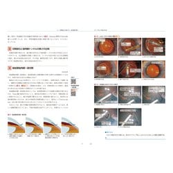 ヨドバシ.com - 連続写真と動画で学ぶ 白内障手術パーフェクトマスター 