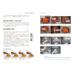 ヨドバシ.com - 連続写真と動画で学ぶ 白内障手術パーフェクトマスター