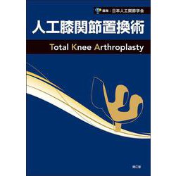 人工膝関節置換術 [単行本]