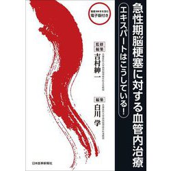 急性期脳梗塞に対する血管内治療―エキスパートはこうしている! [単行本]