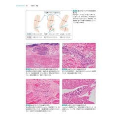 消化管 (非腫瘍性疾患病理アトラス) 消化管 (非腫瘍性疾患病理アトラス) | 九嶋 亮治, 八尾 隆史