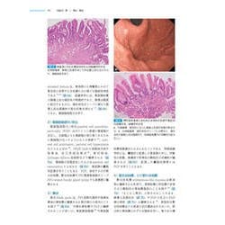 消化管 (非腫瘍性疾患病理アトラス) 消化管 (非腫瘍性疾患病理アトラス) | 九嶋 亮治, 八尾 隆史